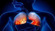 امراض الجهاز التنفسي المزمنة
