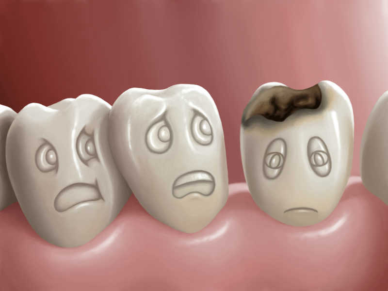 معلومات غريبة عن الاسنان