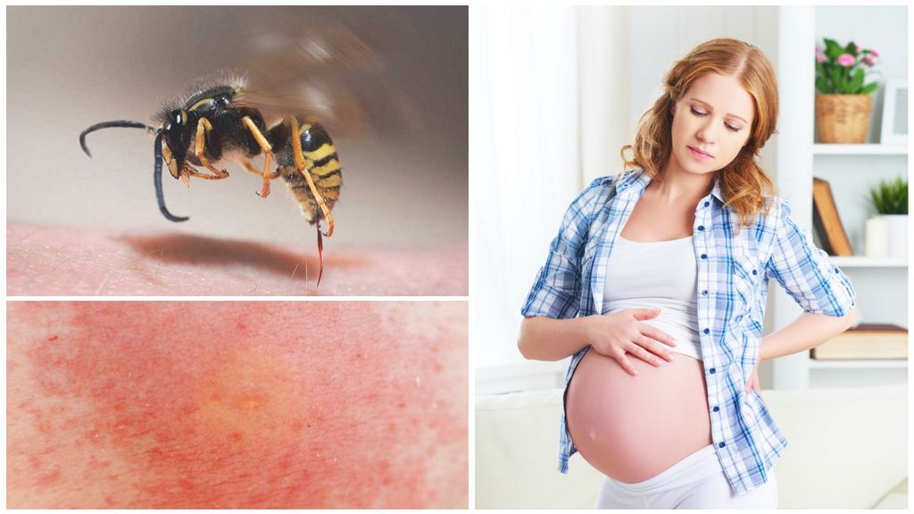 فوائد لسعة النحل للحامل