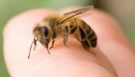 أعراض حساسية سم النحل