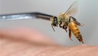 كيفية إعطاء حقن سم النحل