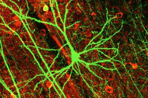 لماذا لا تنقسم الخلايا العصبية