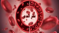 علاج فقر الدم بالتمر