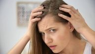 هل نقص الحديد يسبب جفاف الشعر
