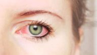 كيف نحافظ على صحة العين