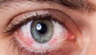 علاج تلف شبكية العين بالاعشاب