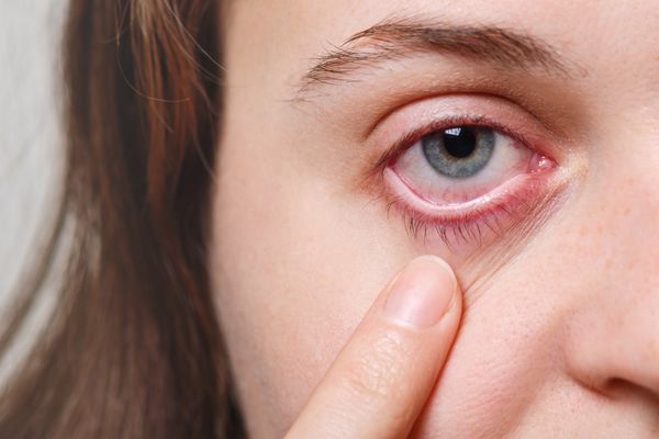 علاج ضعف البصر بالبصل