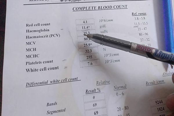 رموز تحليل الدم CBC