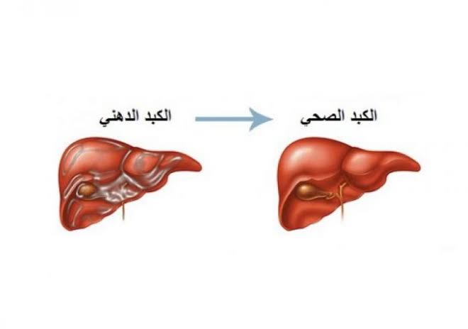 ما علاج الدهون على الكبد